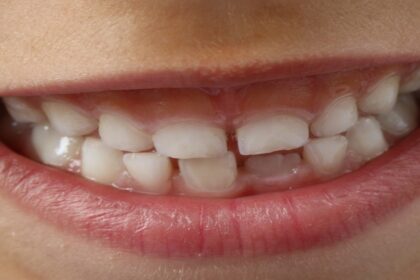 teeth